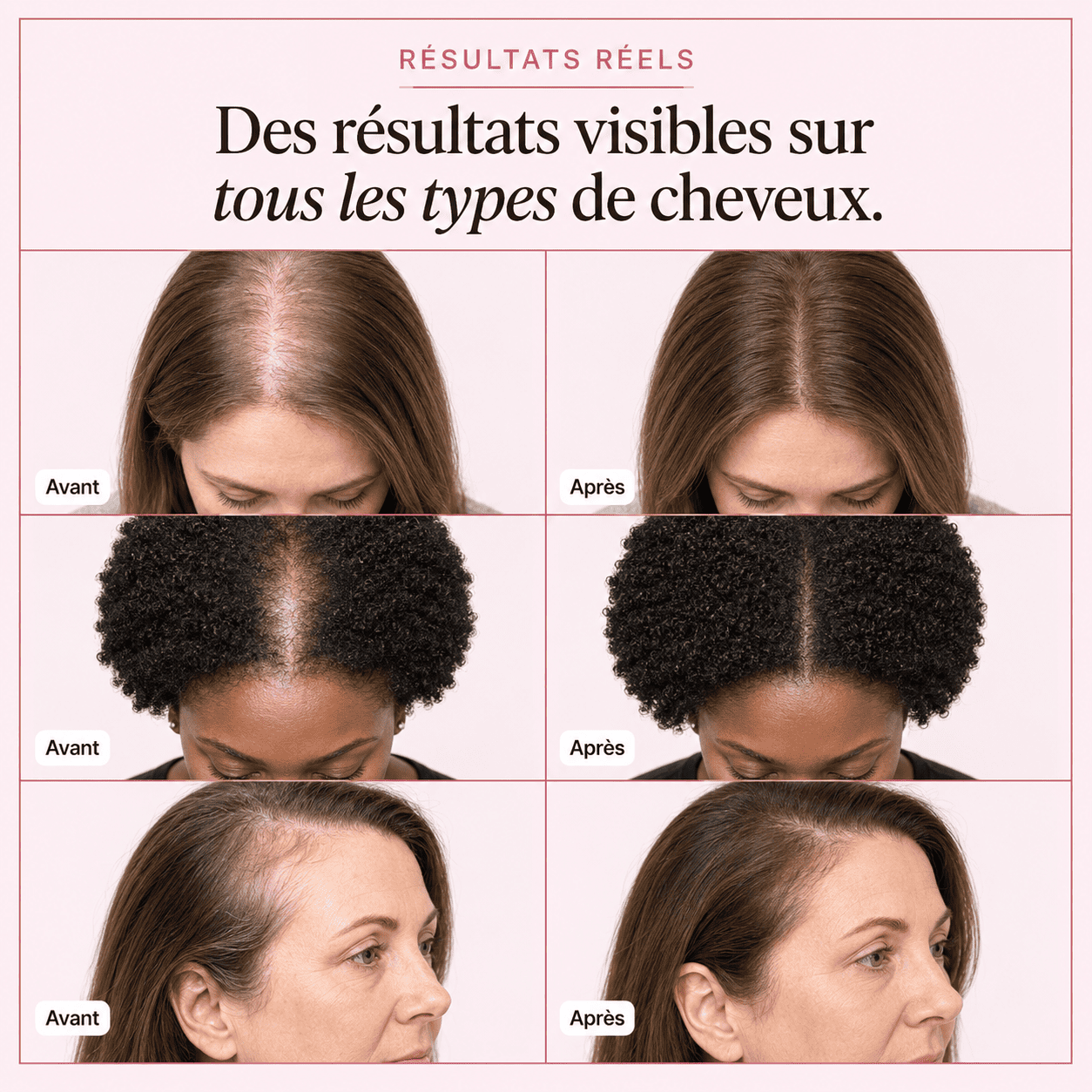 Sérum Capillaire Coréen N°1